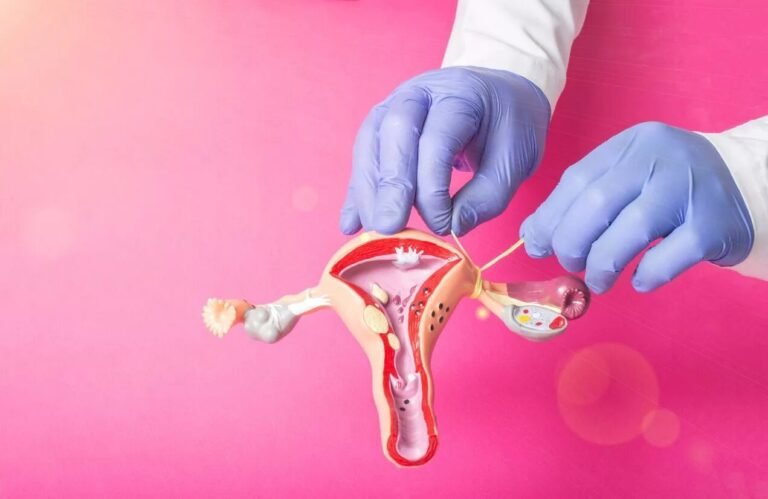 Tubal Ligation