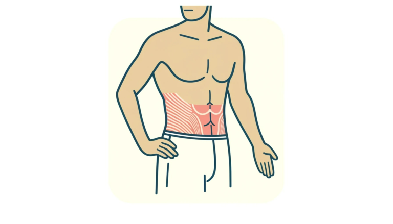 Diastasis Recti in Men